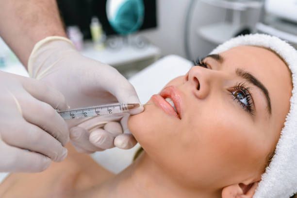 Cover image for Everything You Need to Know About Dermal Fillers in Leeds